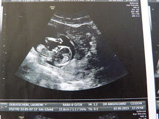 Echographie de foetus Baptiste à 2,5 mois de grossesse