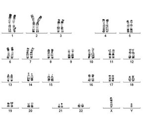 Caryotype d'un garçon sans trisomie